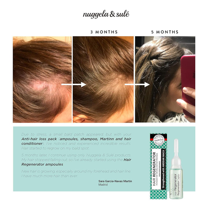 Nuggela & Sulé Haar-Regenerator Ampulle. Effektive Behandlung. Mit Anden-Maca Und Marinem Glykogen. Erhöht Haardichte Und -Stärke. Besonders Für Lichte Haarpartien Geeignet. 1-Wochen-Kur. 1 X 10 Ml